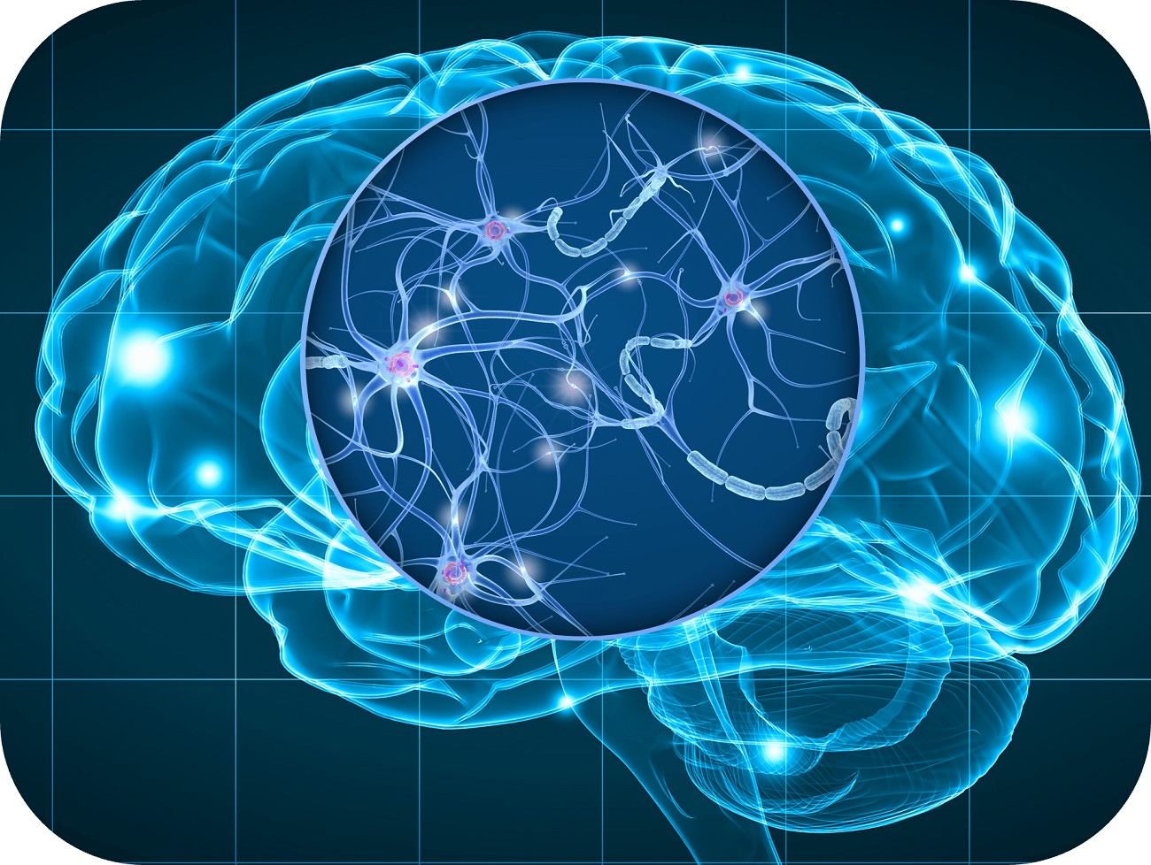 BrainSee