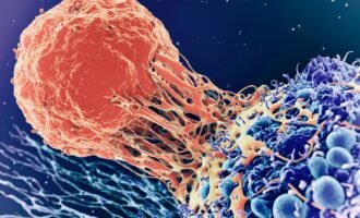 سرطان پوست و کرونا