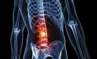 ژن درمانی کمردرد