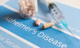 آلزایمر