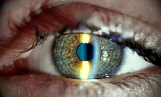 پیوند سلول‌های بنیادی چشم