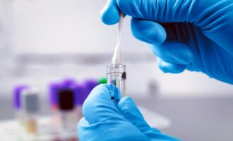 آزمایش تشخیص عفونت