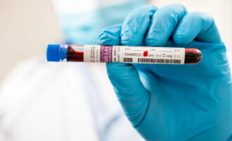 ویروس کشنده